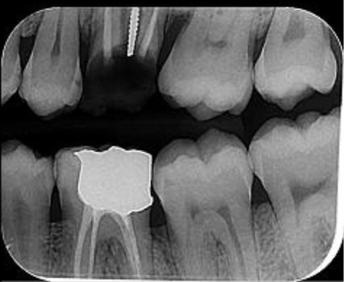 Dental Image