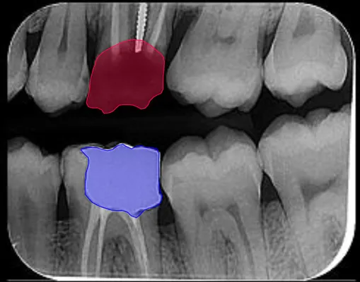 Dental Image hover