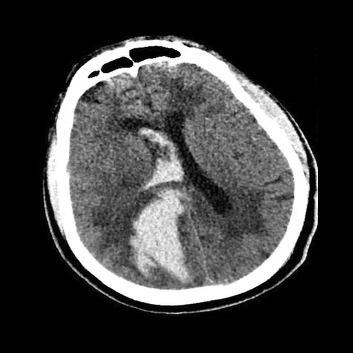 Raw CT Slice 1