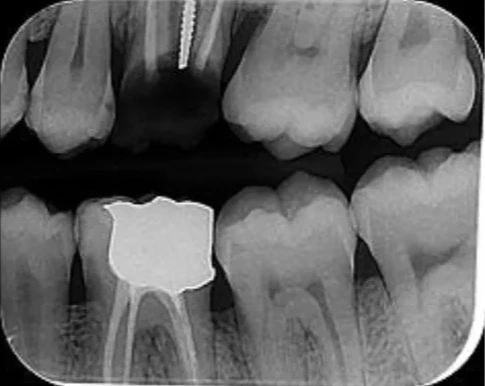 Dental Radiograph Original (Before)